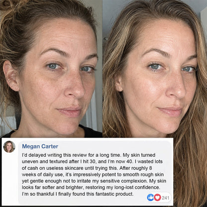 Collagen Plump & Repair Balm – ✨ Plump & Smooth in Minutes